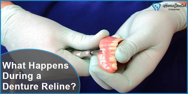 What Happens During a Denture Relin