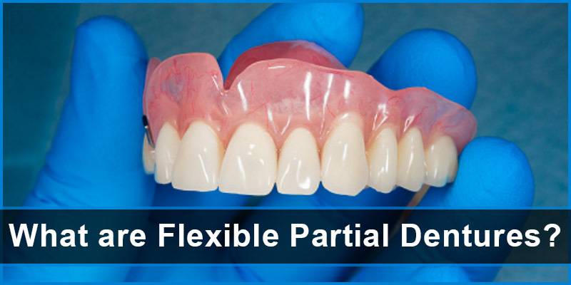 What are Flexible Partial Dentures