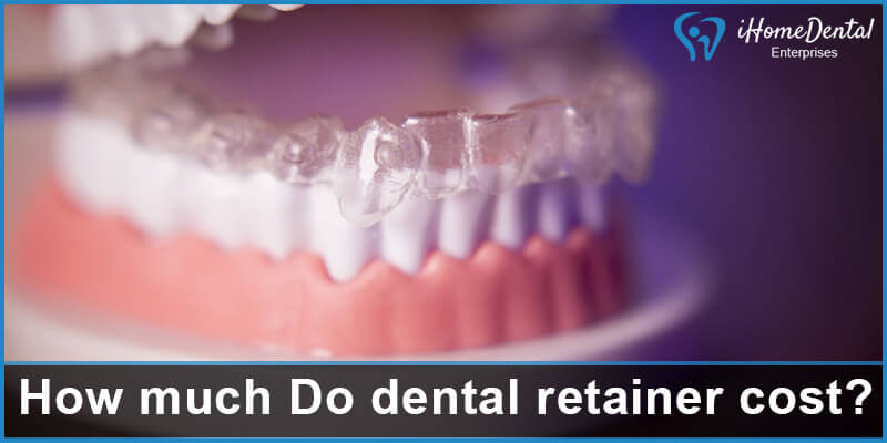 How much Do dental retainer cost