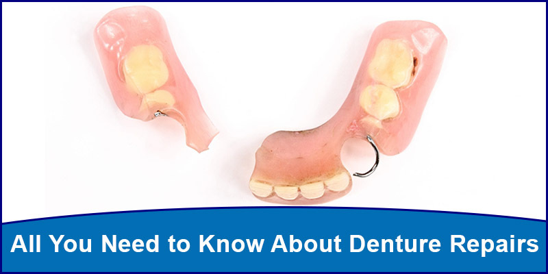 All You Need to Know About Denture Repairs