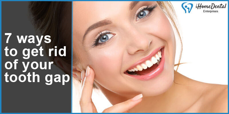 7 ways to get rid of your tooth gap