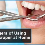 The Dangers of Using Dental Scraper at Home