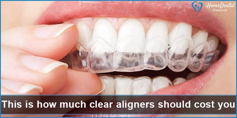 This is how much clear aligners should cost you