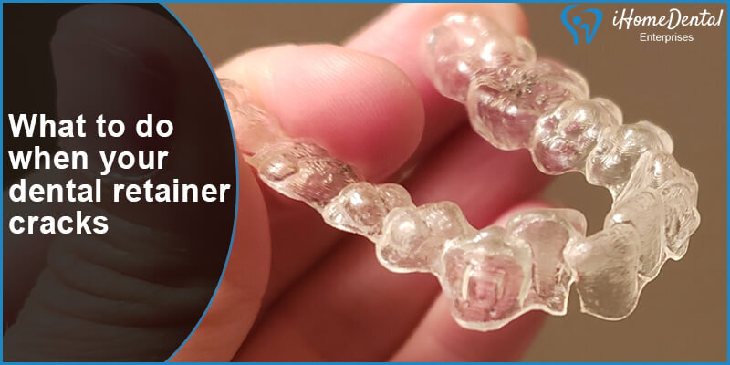 What to do when your dental retainer cracks