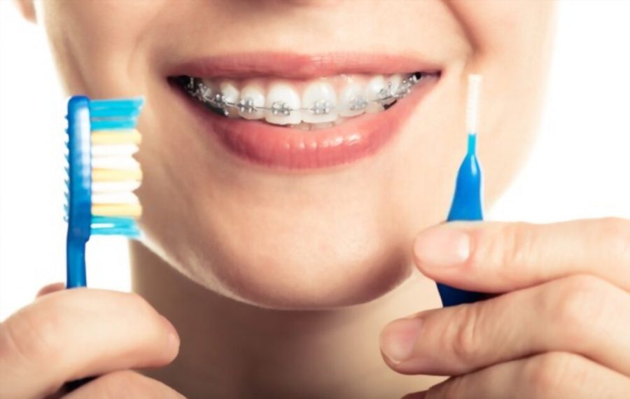 My Retainer Smells Bad What can I do? iHome Dental