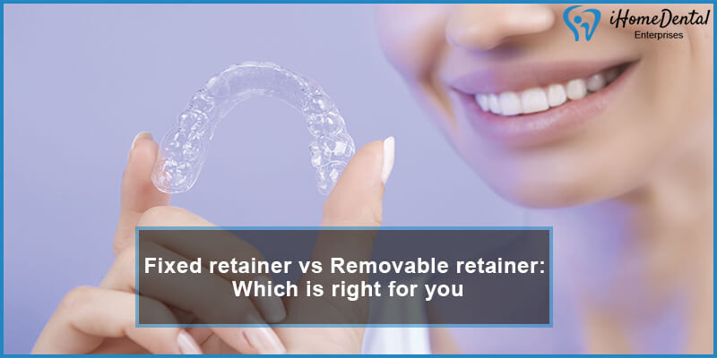 fixed retainer vs removable retainer which is right for you