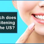 teeth whitening cost in the us