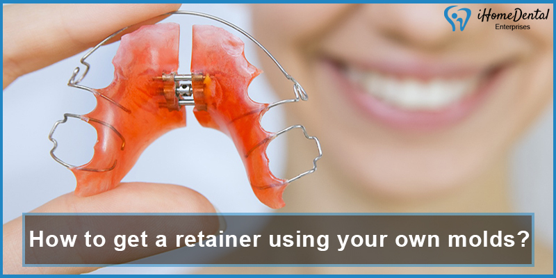 how to get a retainer using your own molds