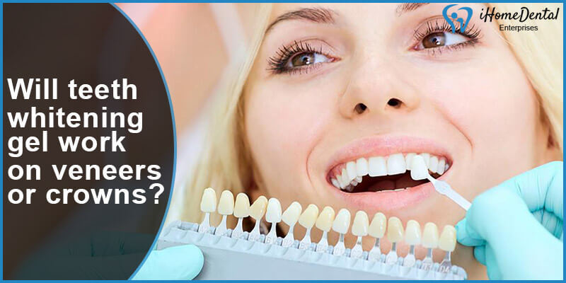 will teeth whitening gel work on veneers or crowns