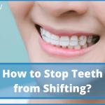 How to Stop Teeth from Shifting