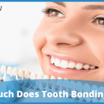 How Much Does Tooth Bonding Cost