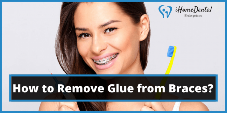 How To Remove Dental Glue From Teeth At Home