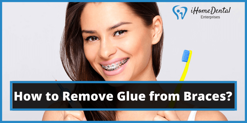 How to Remove Glue from Braces